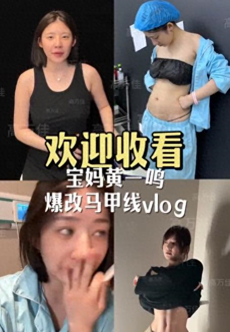 输给47岁老将!张水华获亚军+10.4万奖金 回应:骨折还没好