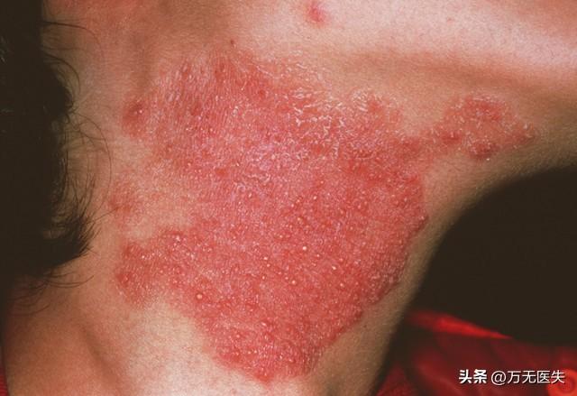 重磅消息曝出!湖人迎来引进墨菲三世的交易契机,全力辅佐东契奇